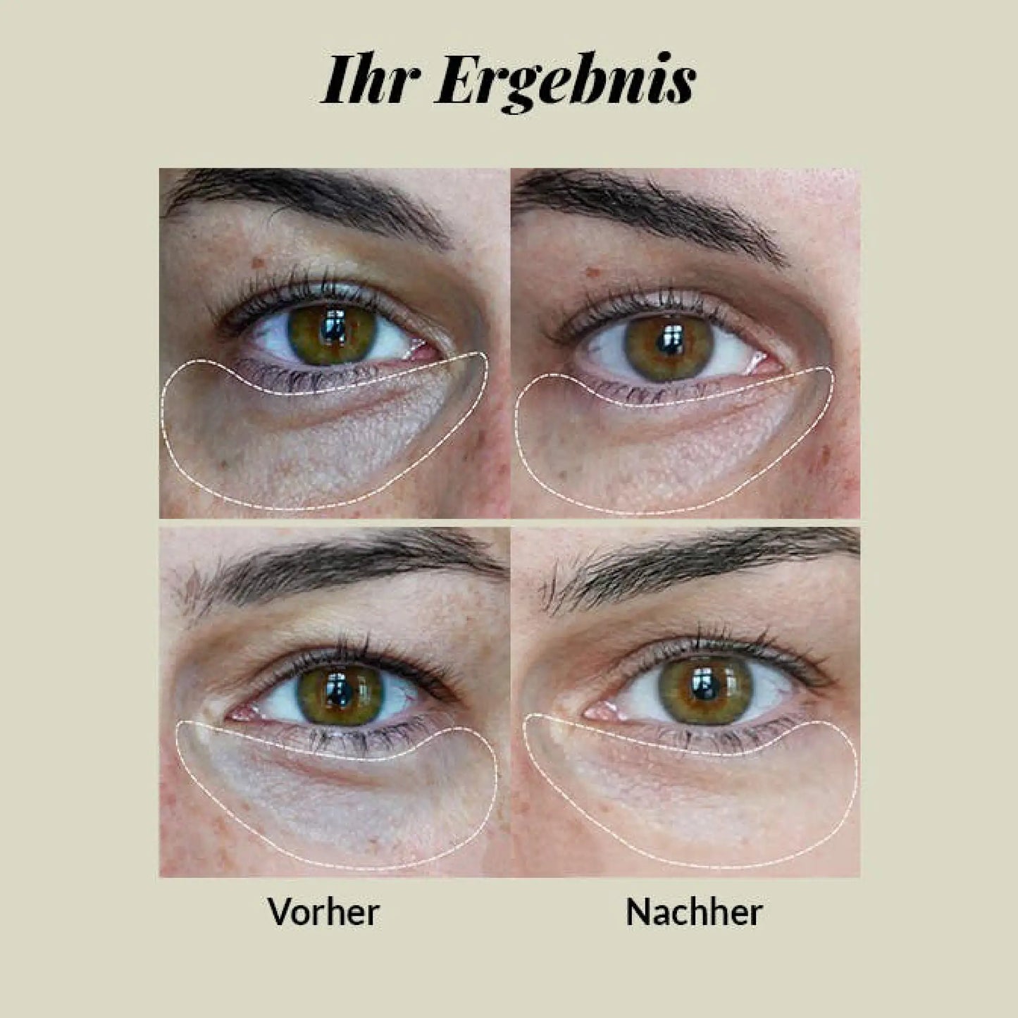 Creme para os Olhos - CBD & Ácido Hialurónico